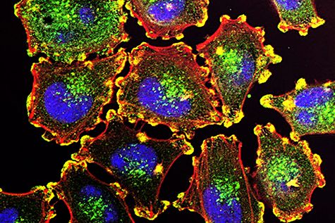 Microscopic view of a disease